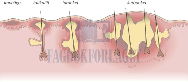 fig14-7.jpg