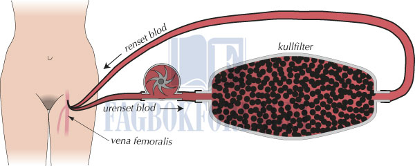 fig14-3.jpg