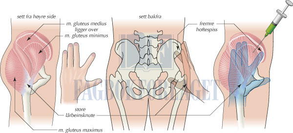 fig5-6.jpg