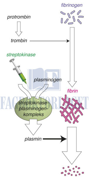 fig11-11.jpg