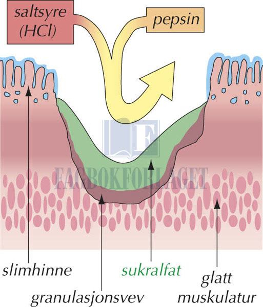 fig10-8.jpg