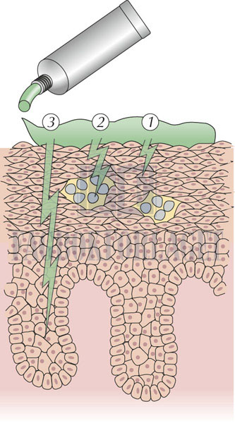 fig14-6.jpg