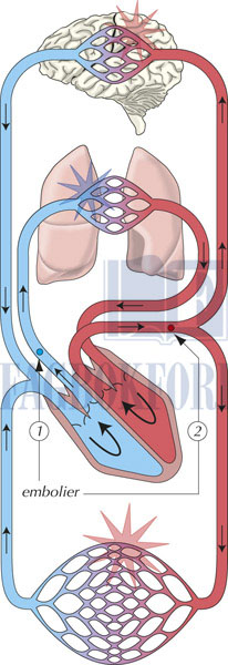 fig11-7.jpg