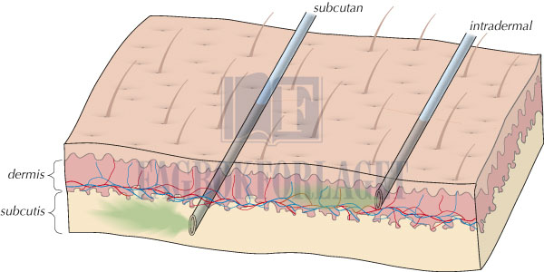 fig5-7.jpg