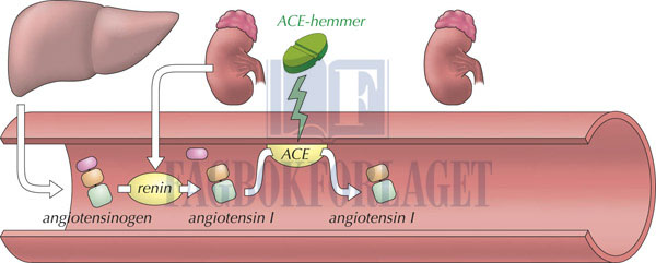 fig8-18.jpg