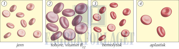 fig11-4.jpg